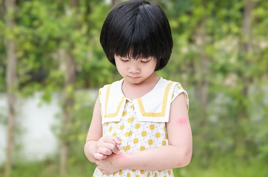 Alergi pada Anak